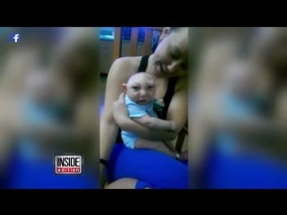 Baby born with large part of skull missing adorably says 'hello'