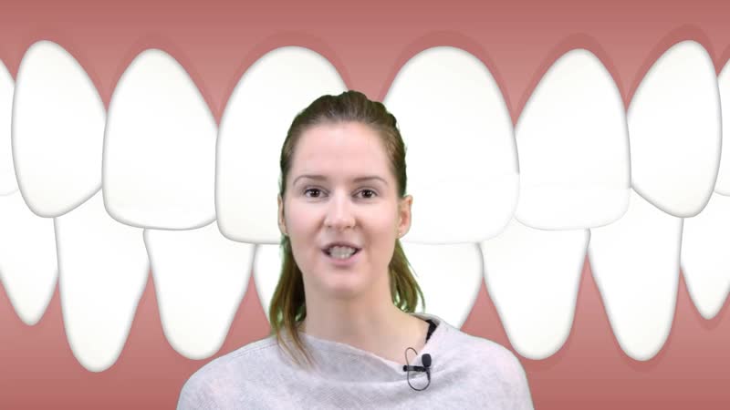Vorsicht! zahnpasta macht weisse bis braune flecken auf den zähnen cornelia schmidt