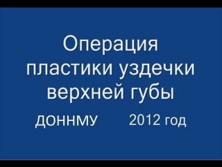 Операция пластики уздечки верхней губы (френулопластика) при диастеме молодые стоматология