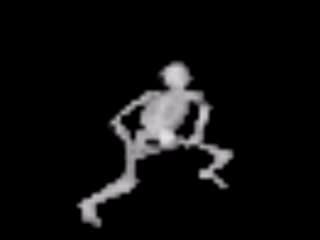 Скелет флексит