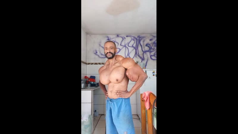 Импланты в груди