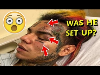 Tekashi 6ix9ine allegedly got pistol whipped, kidnapped, and robbed for all his jewelry!