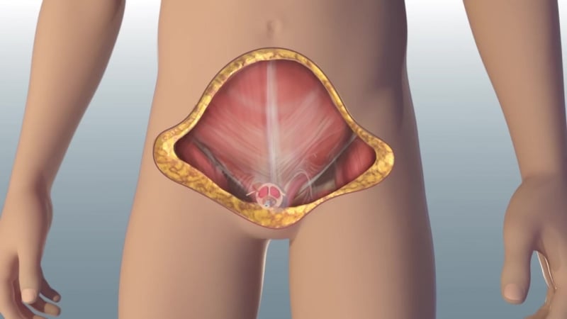 Worlds first total penile and scrotum transplant johns hopkins medicine