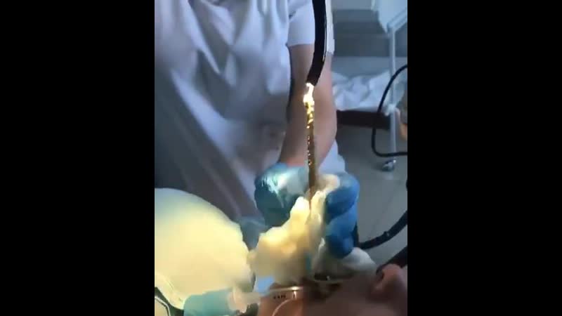 Женщине во время сна в рот заползла змея!