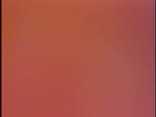 Dental implant broken screw retrieval case 2 gerard cuomo dds1015