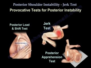 Posterior shoulder instability,jerk test everything you need to know dr nab