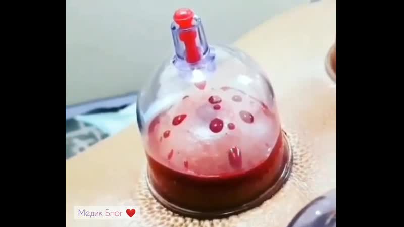 🤔 как относитесь к такому методу лечения?