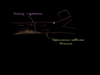 Стеноз, ишемия и сердечная недостаточность