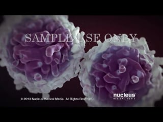 Medical animation hiv and aids