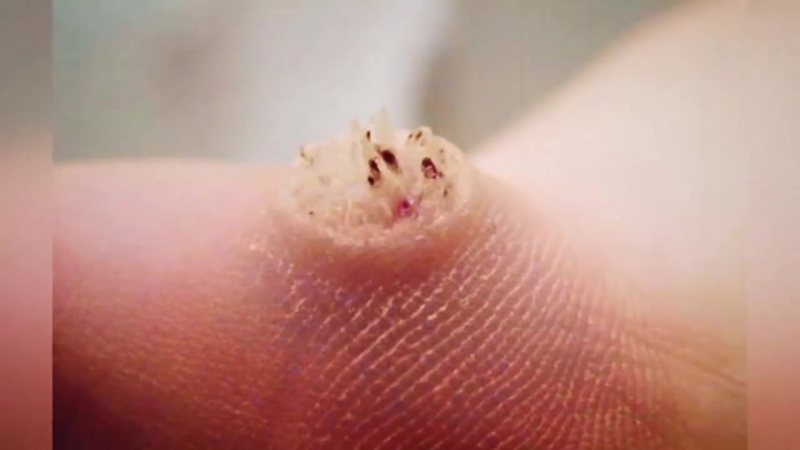 10 отвратительных фактов о человеческом теле