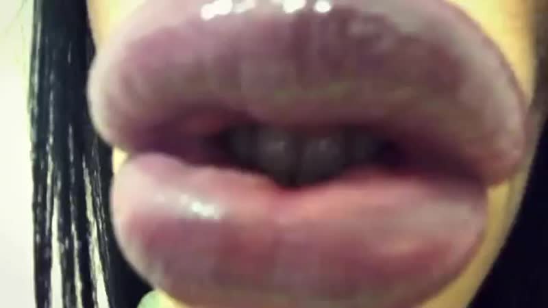 #lipsfiller #lipfiller #biglips #hugelips #siliconelips #пухлыегубы #силиконовыегыбы #большиегубы #филлер #filler #fillers #lips