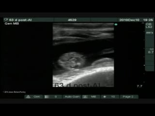 Embryonic and fetal development from d 29 to 75 post ai in a lactating holstein cow