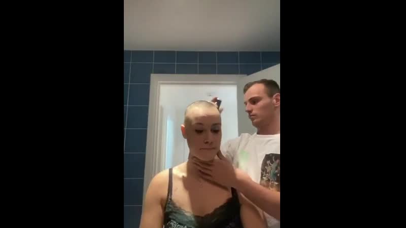 Девушка страдающая алопецией попросила мужа по брить её наголо, а он поддержал её как смог!