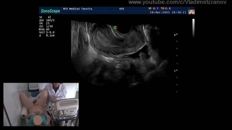 Практическое занятие узи органов малого таза у женщин