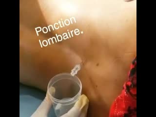 Люмбальная пункция