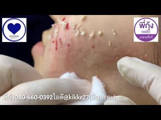 Множество белых угрей