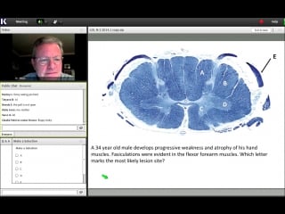 13th lecture kaplan step 1 ca anatomy(neuroscience) white jan 21, 2014