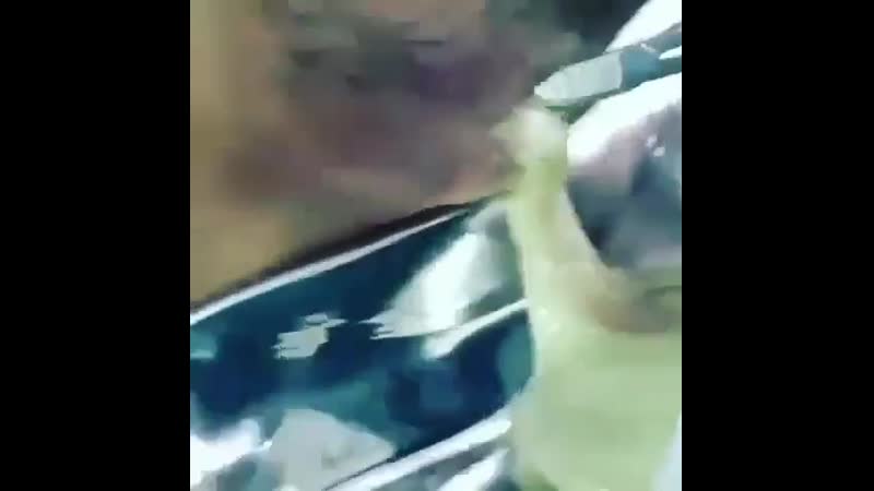 Воскресное вскрытие абсцесса 🤗