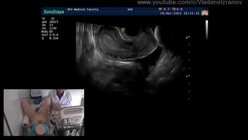 Практическое занятие узи органов малого таза у женщин