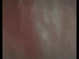 Механизм действия ботулотоксина