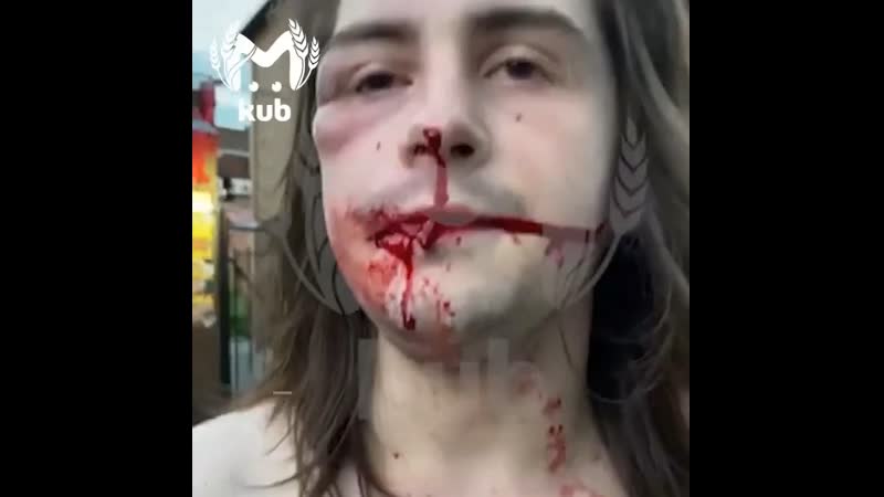 В сочи бородач избил парня из за его длинных волос