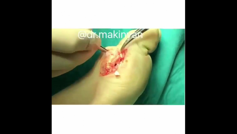 Внимание! лицам со слабой психикой, беременным и детям просьба смахнуть ленту, а если посмотрели просьба не осуждать