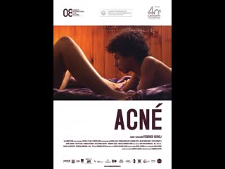 Угри acné (2008) мексика