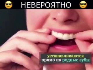 Perfect smile veneers дарят привлекательную белоснежную улыбку