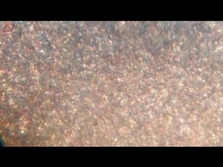 Грудное молоко под мискроскопом