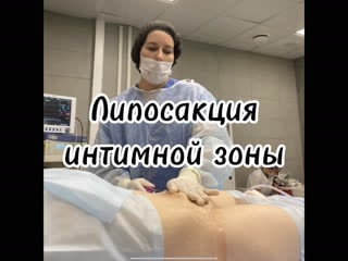 Липосакция интимной зоны