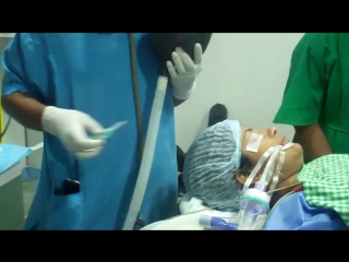 Endotracheal extubation demonstrated frcs