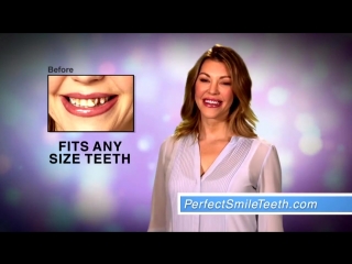 Perfect smile veneers дарят привлекательную белоснежную улыбку