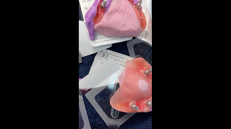 Немедленная нагрузка