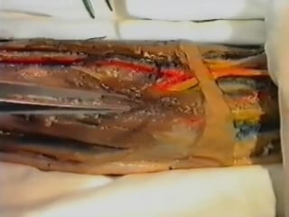 Топографическая анатомия локтевой области