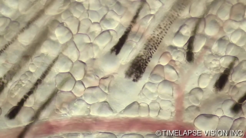 Корень волоса под микроскопом (vhs video)