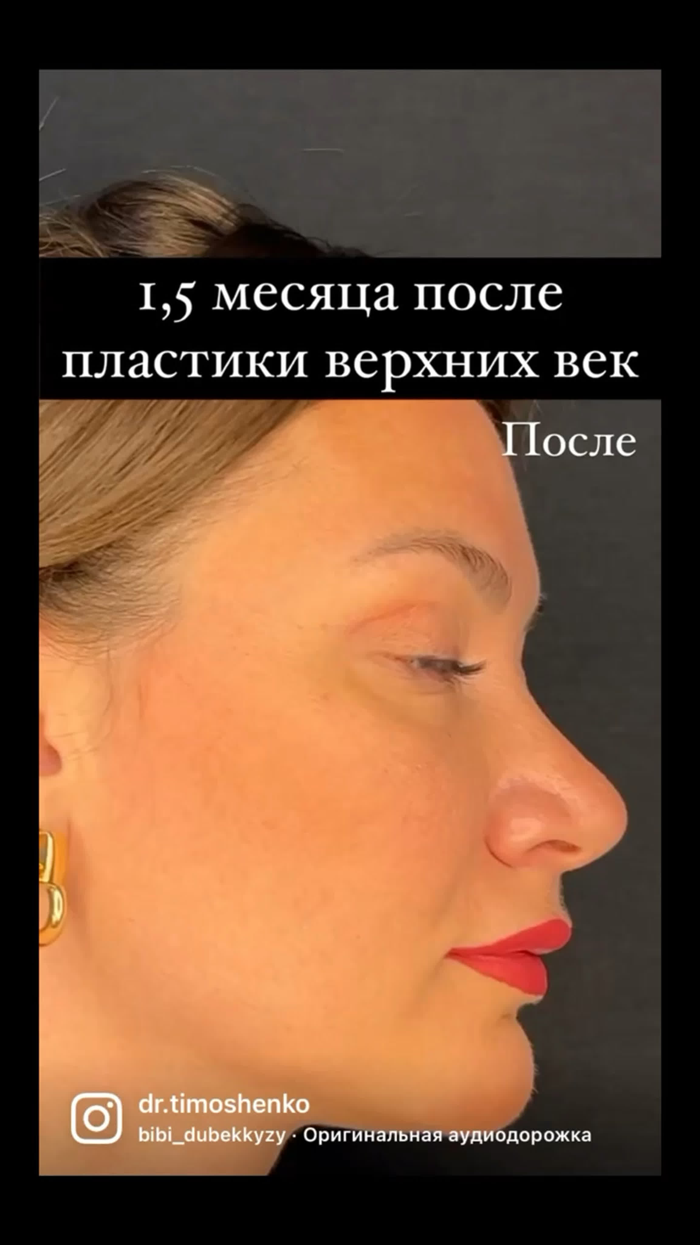 Видео от пластический хирург саратов тимошенко александр watch online