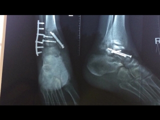 Вызвал "убер"