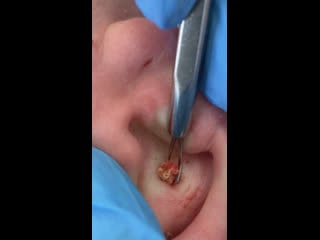 Кожное сало