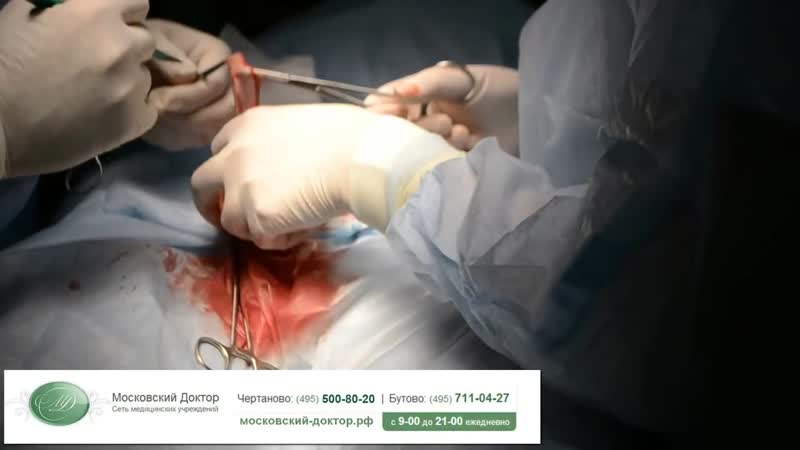 Обрезание крайней плоти циркумцизия