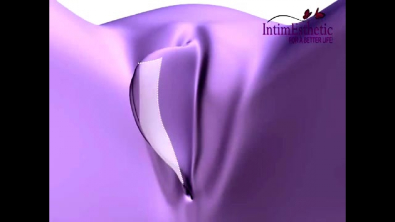 Родов porn video – Женское обрезание (коррекция половых губ после родов)
