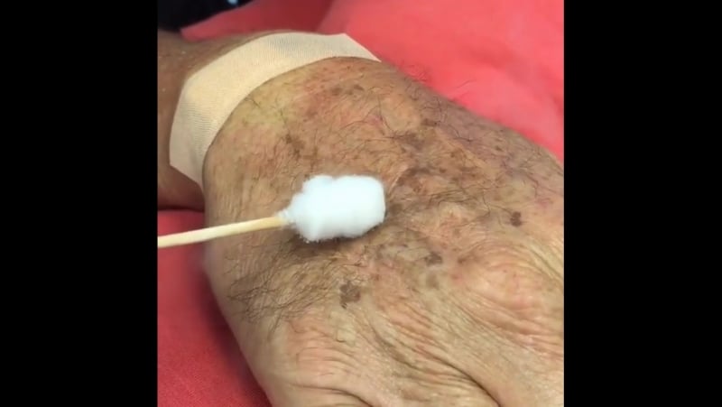 Профессионально удаление бородаи