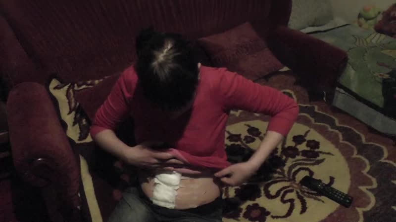 Молодая мать, макеевчанка, начав сама сбивать сосульки за окном выпала и очень серьезно травмировалась