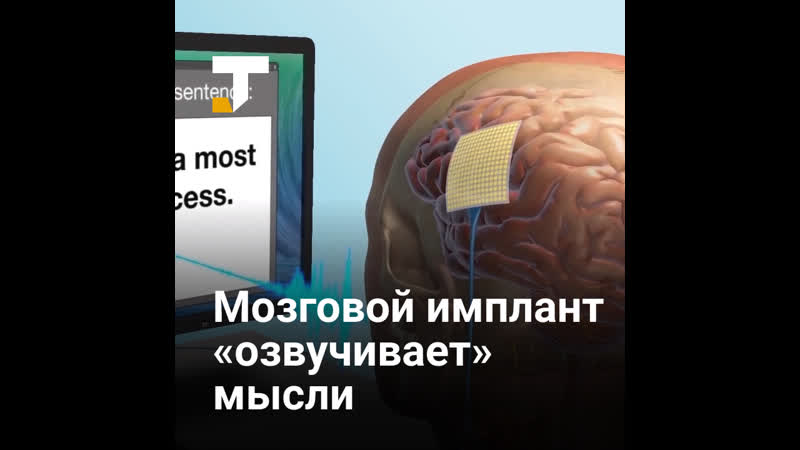 Учёные создали мозговой имплант, «озвучивающий» мысли
