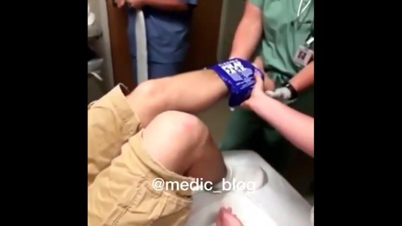 Перелом лодыжки