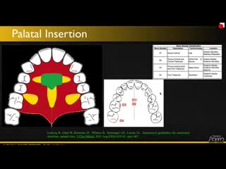 Dental treatment accelerated orthodontics jan 2018 ортодонтия