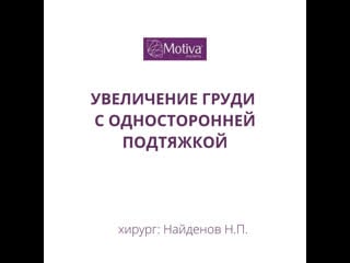 Увеличение груди с односторонней подтяжкой