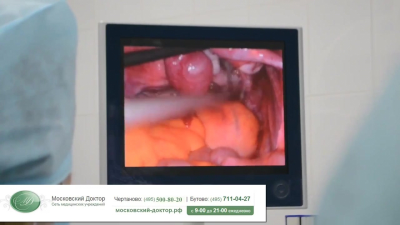 Анализ на непроходимость маточных труб