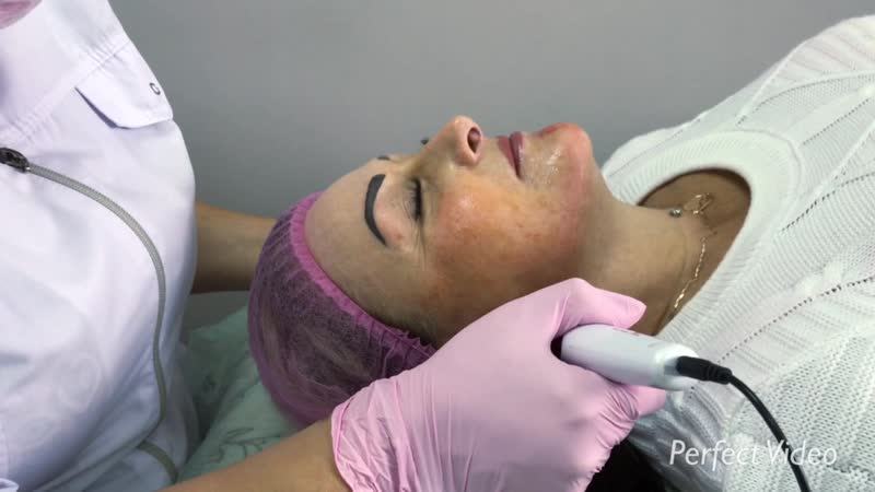 Фракционная мезотерапия в beauties