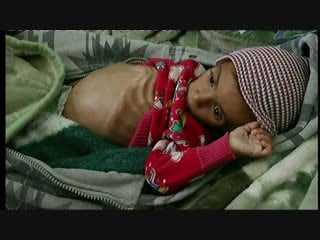 Oct 2018 starvation in yemen