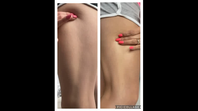 Результат от коллагена